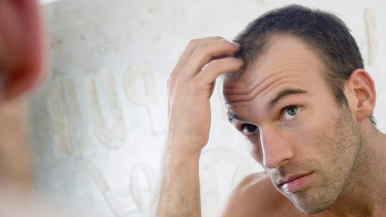 10 Baldness Myths You Should Stop Believing