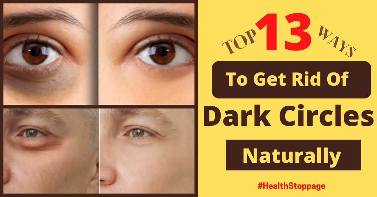 Natural Ways To Get Rid of Dark Circles Under Eyes - Health Stoppage